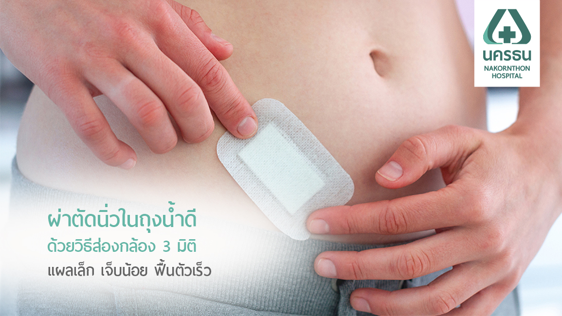 “นิ่วในถุงน้ำดี” กับวิธีการรักษาด้วยเทคโนโลยีส่องกล้อง 3 มิติ